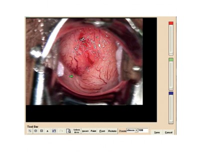 Colposcopie logiciel de gestion d'images, vidéos et données des patients